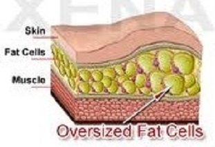 Fat Cells In Body 28